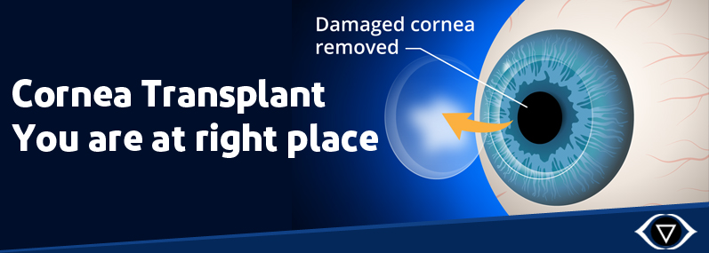 cornea-transplant