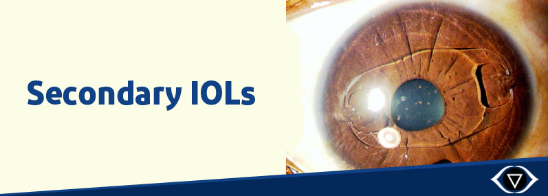 secondary iols banner