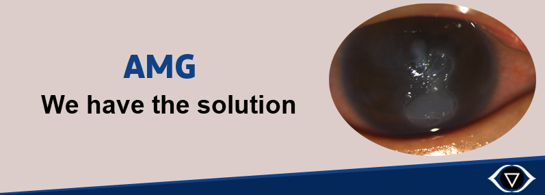 amniotic membrane grafting in Ambala