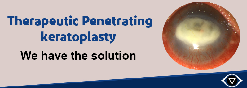 Optical Penetrating Keratoplasty