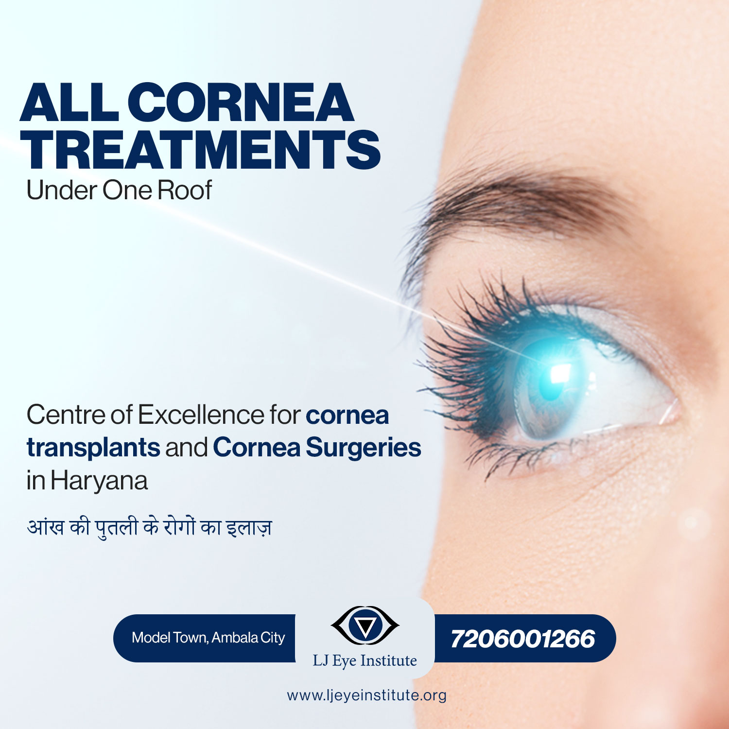 Cornea Hospital in Ambala | MOST TRUSTED HOSPITAL FOR CORNEA SURGERY IN HARYANA