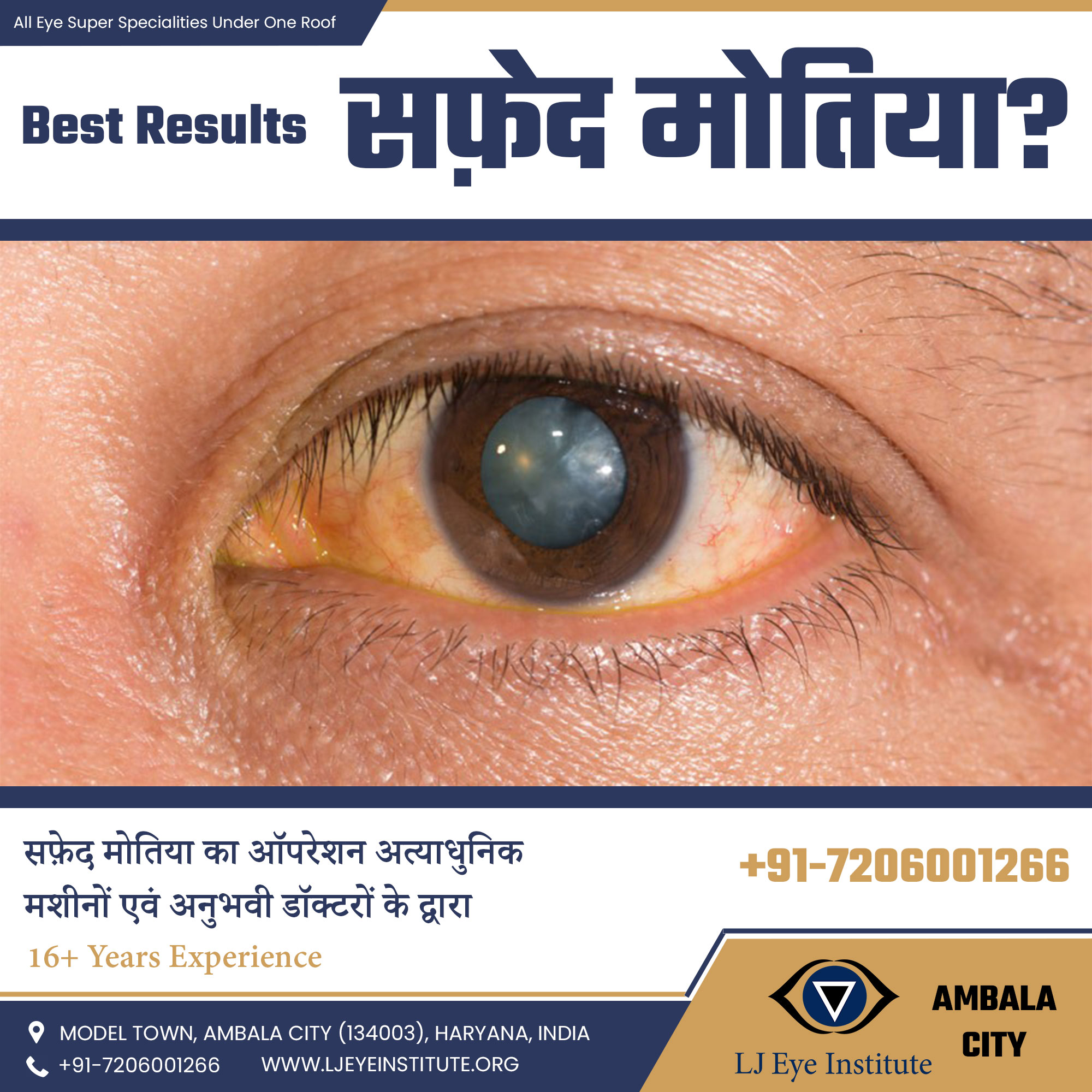 Best Cataract Surgery in Ambala | LJ Eye Institute