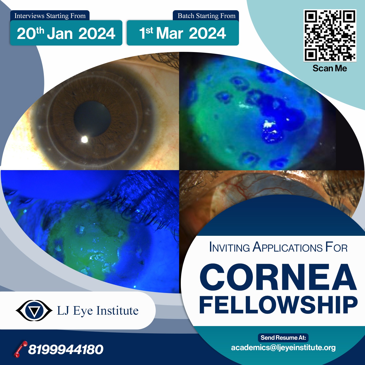 Cornea Fellowship in India | Cornea Fellowship in Haryana | Cornea Fellowship in Punjab