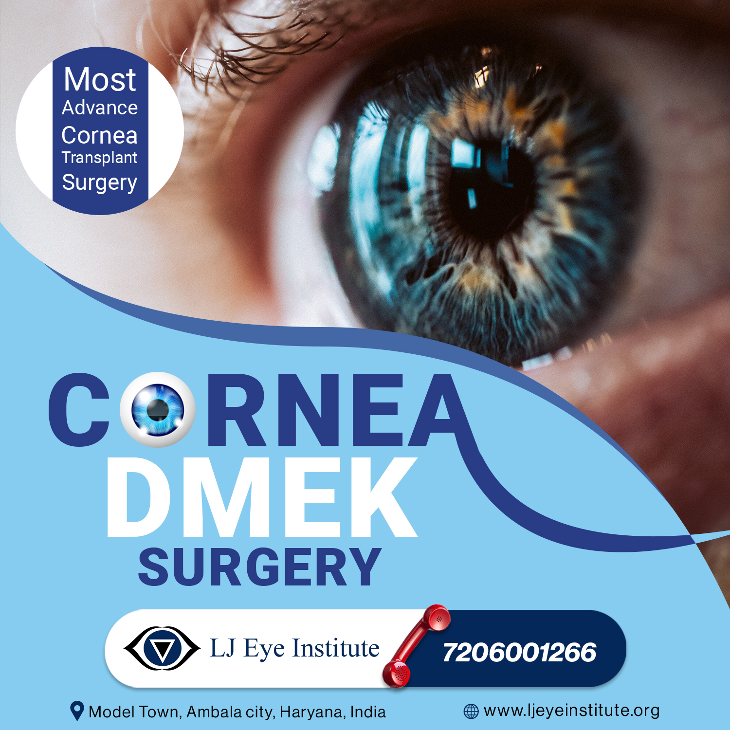DMEK Surgery in Haryana | Cornea Surgeries in India