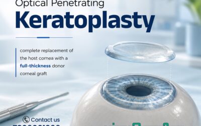 Optical Penetrating Keratoplasty: Procedure, Benefits, Risks & Recovery